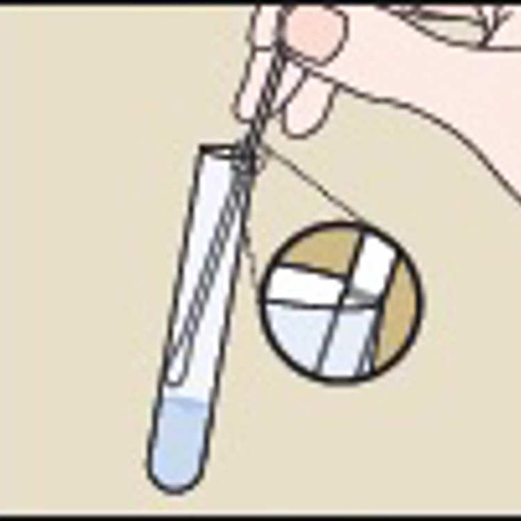 Chlamydia Test