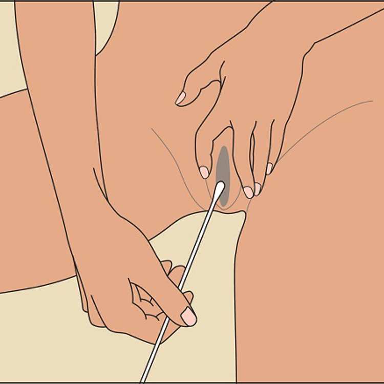 Swab in vagina