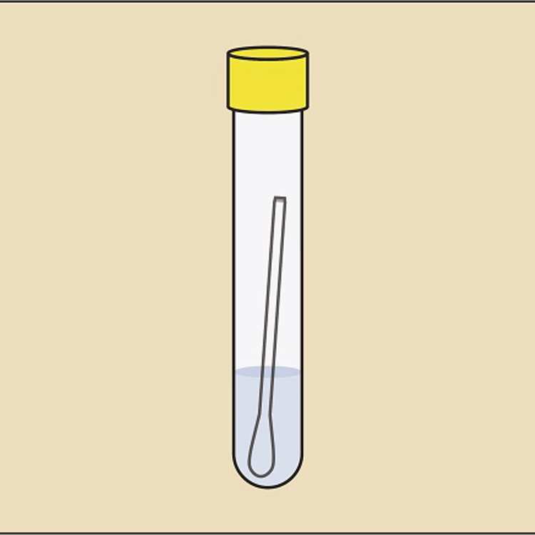 STI test