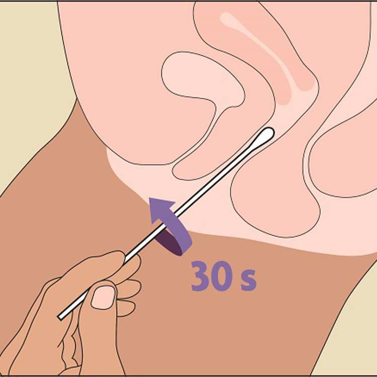 STI vagina swab