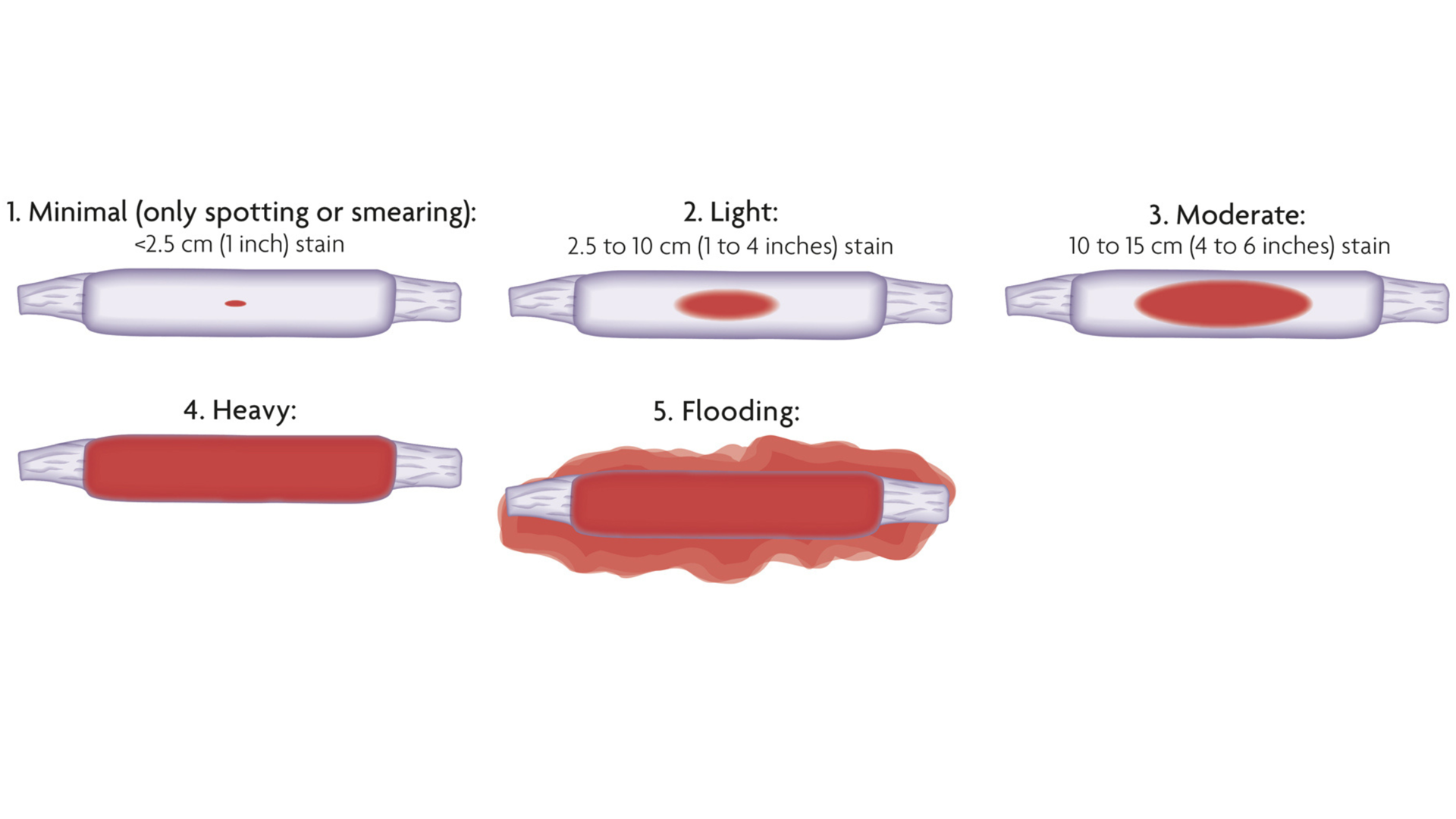 Bleeding Chart 